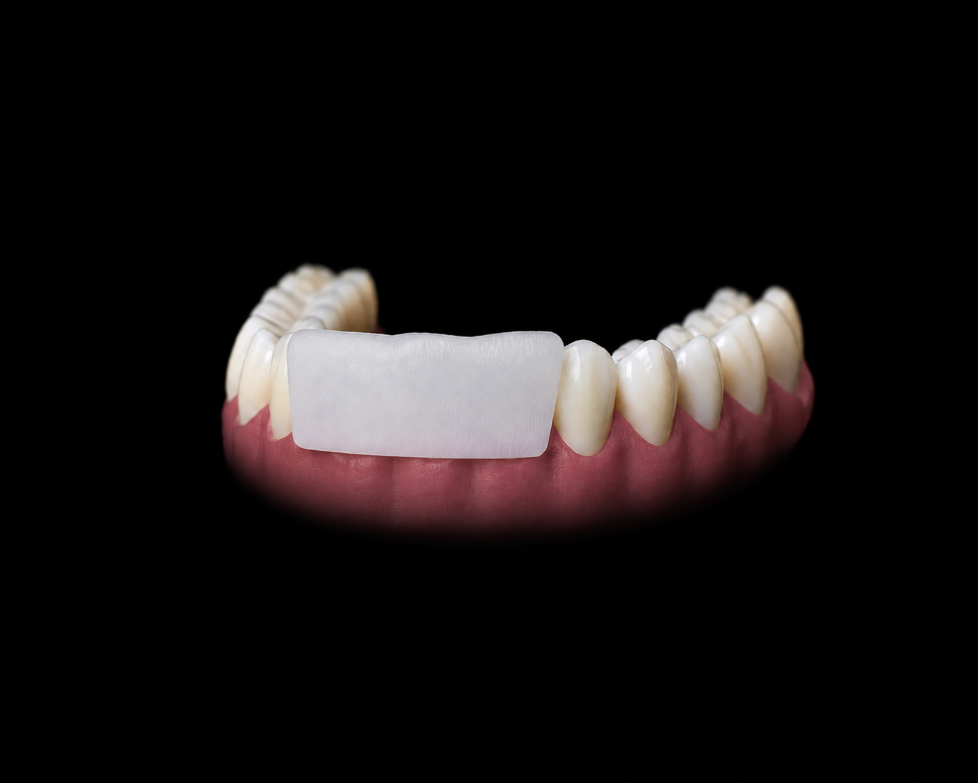 Liprotek Lip Guard